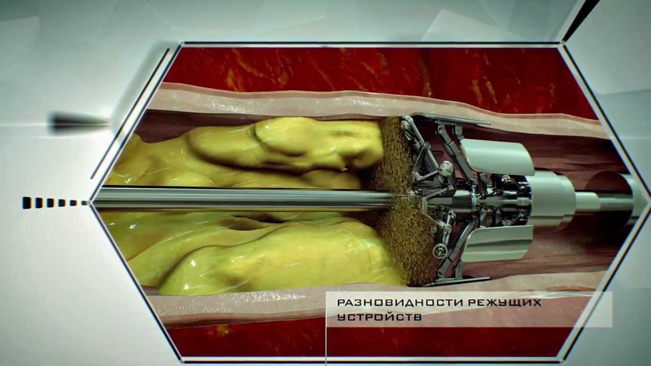 /static/pages-images/blog/video-localization-dubbing-subtitles/index-4