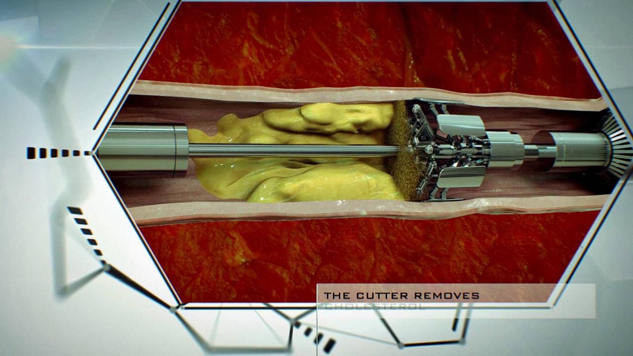 /static/pages-images/blog/video-localization-dubbing-subtitles/index-5